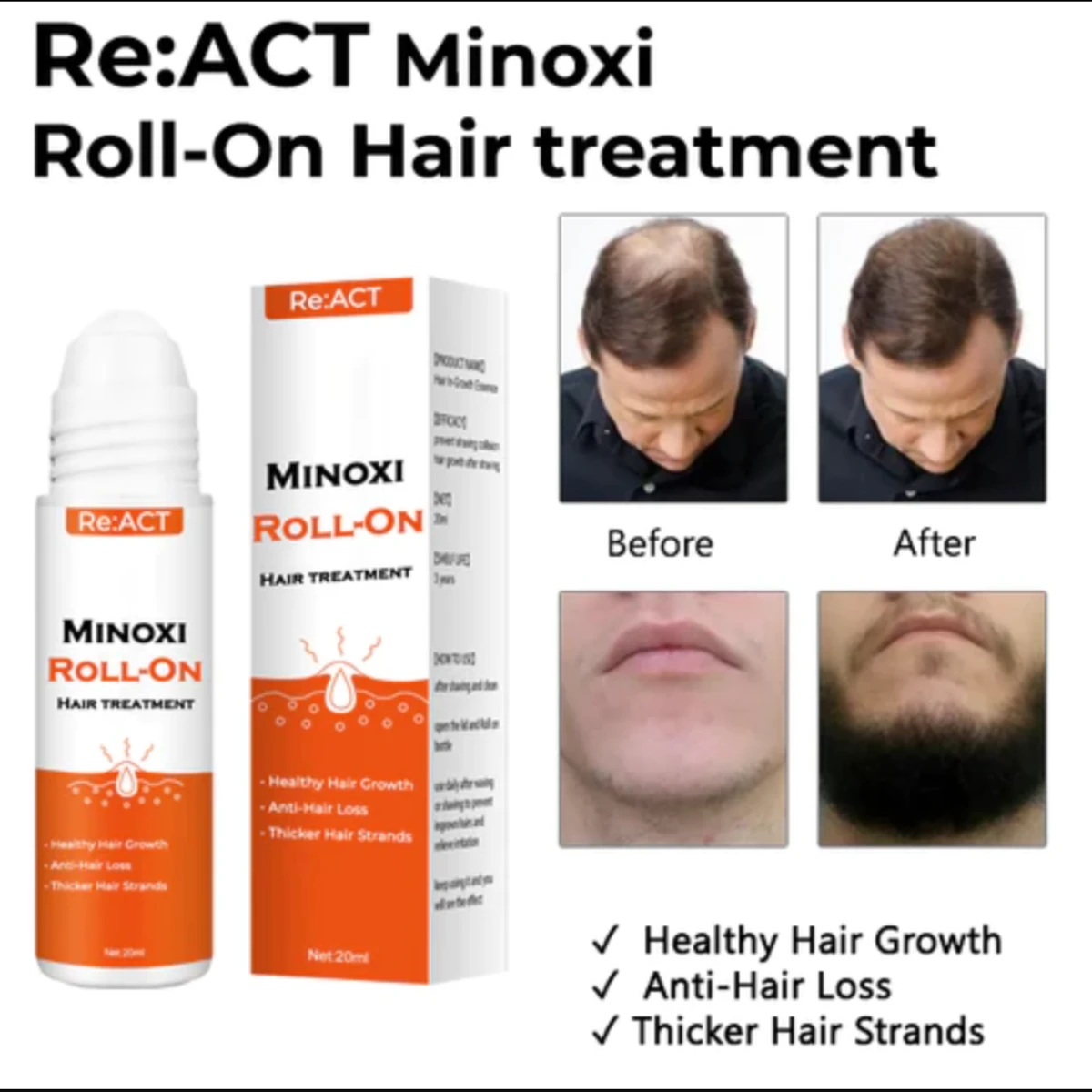 Exalted Minoxi Roll-On Hair Treatment